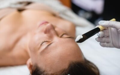 Czy po mezoterapii bezigłowej można się opalać?