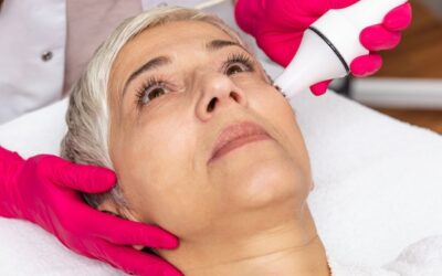 Hifu kiedy widać efekty po zabiegu?