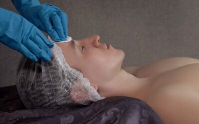 Jak wygląda twarz po mezoterapii igłowej i czego można się spodziewać?