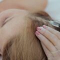 Mezoterapia skóry głowy co to i kiedy warto ją rozważyć?