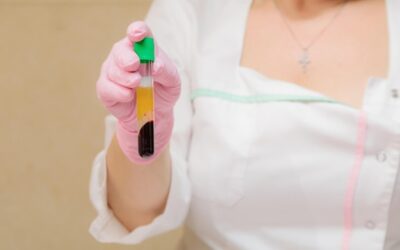 Osocze dla kogo będzie odpowiednim zabiegiem?