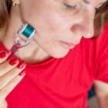 Jak stosować derma roller w codziennej pielęgnacji?