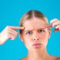 Jak zlikwidować zmarszczki między brwiami bez ingerencji chirurgicznej?