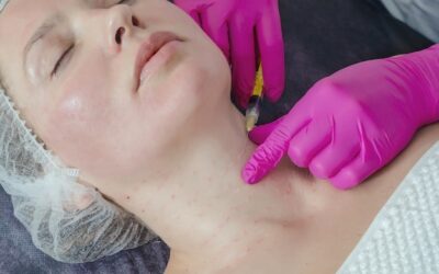 Mezoterapia osoczem kiedy efekty są widoczne?