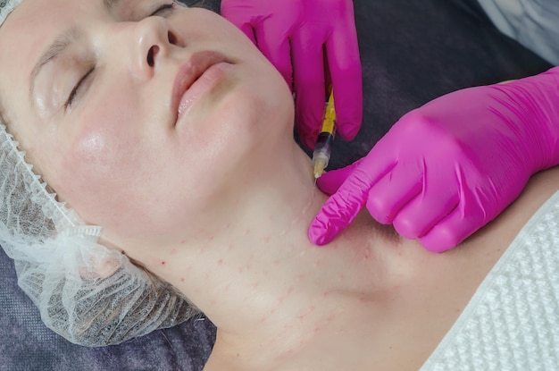 Mezoterapia osoczem kiedy efekty są widoczne?