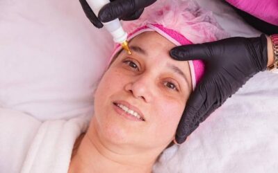 Czym smarować twarz po mezoterapii mikroigłowej, aby wspomóc regenerację skóry?