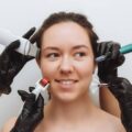 Dermapen czy mezoterapia mikroigłowa – co wybrać dla swojej skóry?