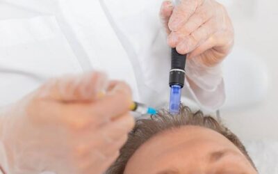 Jak często robić mezoterapię mikroigłową, żeby zauważyć efekty?