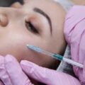 Jak działa botulina i kiedy warto z niej skorzystać?
