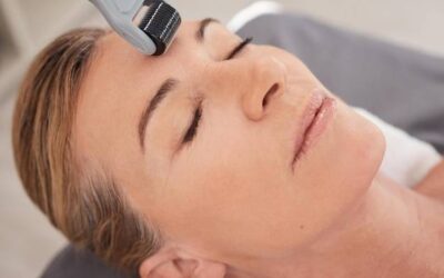 Jak używać rollera z igłami do twarzy, żeby poprawić kondycję skóry?