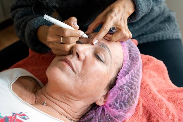 Jaki zabieg na zmarszczki na czole wybrać?