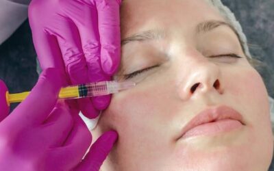 Osocze bogatopłytkowe jak się wygląda po zabiegu?