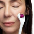 Derma roller jak często stosować, by zobaczyć efekty?