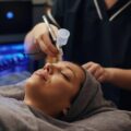 Dermapen jak często powtarzać zabieg dla najlepszych efektów?
