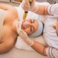 Dermapen co po zabiegu warto wiedzieć?