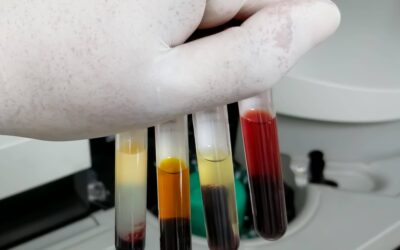 Jak działa osocze bogatopłytkowe w regeneracji skóry?