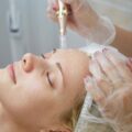 Mezoterapia igłowa co ile warto powtarzać zabieg?