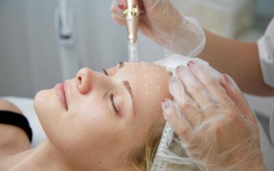 Mezoterapia igłowa co ile warto powtarzać zabieg?