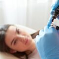 Mezoterapia igłowa jak długo się goi po zabiegu?