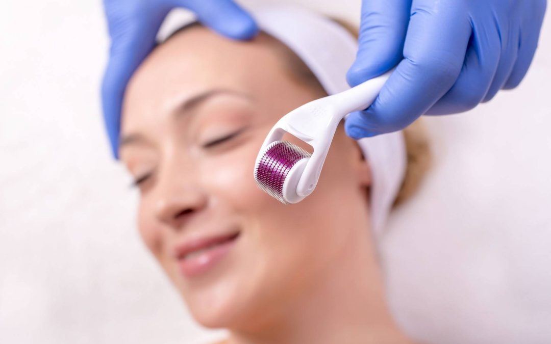 Dermaroller czy dermapen co warto wybrać do domowej pielęgnacji?