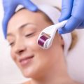 Dermaroller czy dermapen co warto wybrać do domowej pielęgnacji?