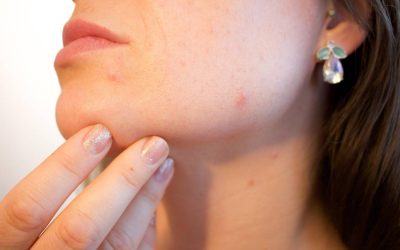 Jak dezynfekować derma roller w domowych warunkach?